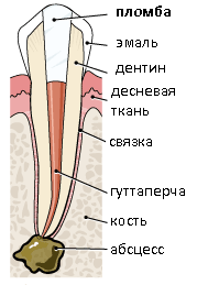 Воспаление кости верхушки корня зуба