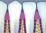 Здоровые зубы, не нуждающиеся в пародонтологическом лечении