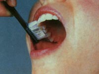 Как правильно чистить зубы. Наружные поверхности зубов