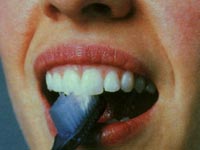 Методика чистки задних поверхностей зубов
